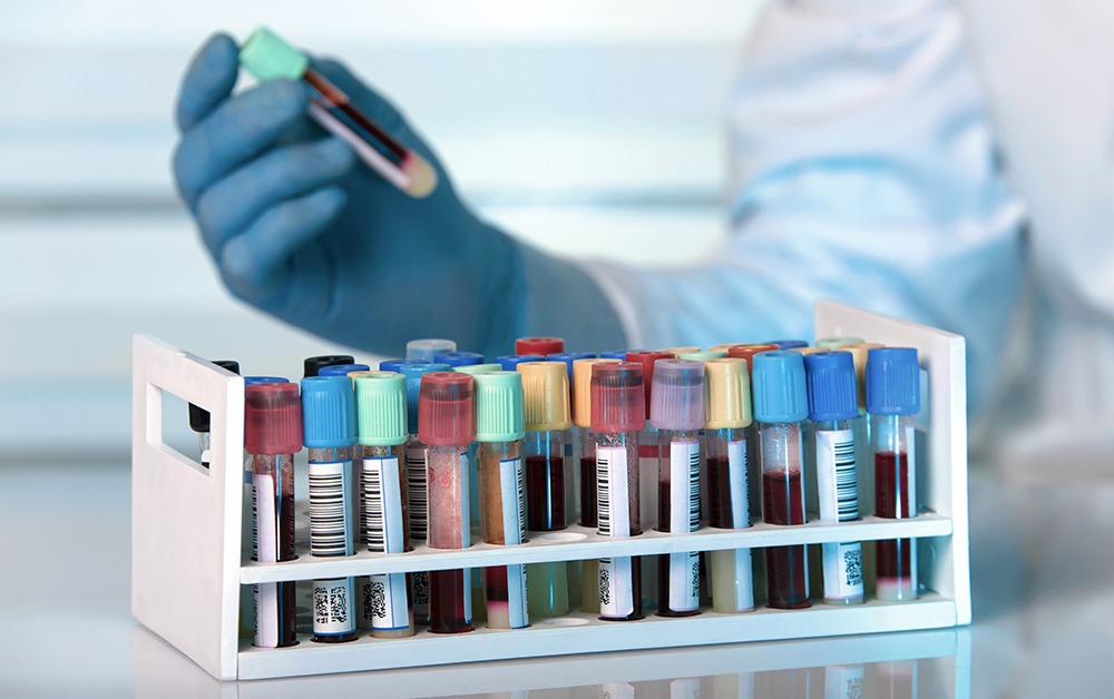 Blood samples in the laboratory